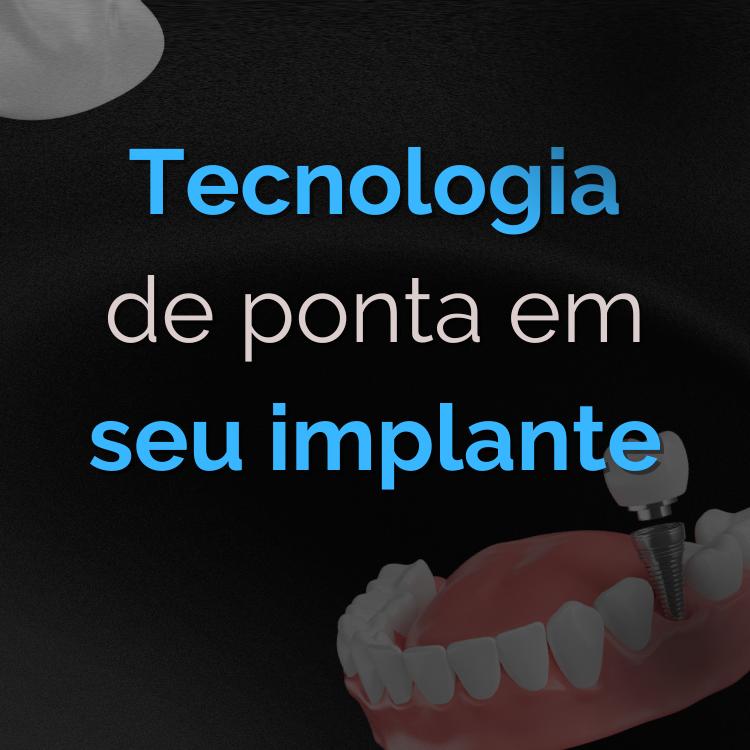 TECNOLOGIA DE PONTA EM SEU IMPLANTE (1)